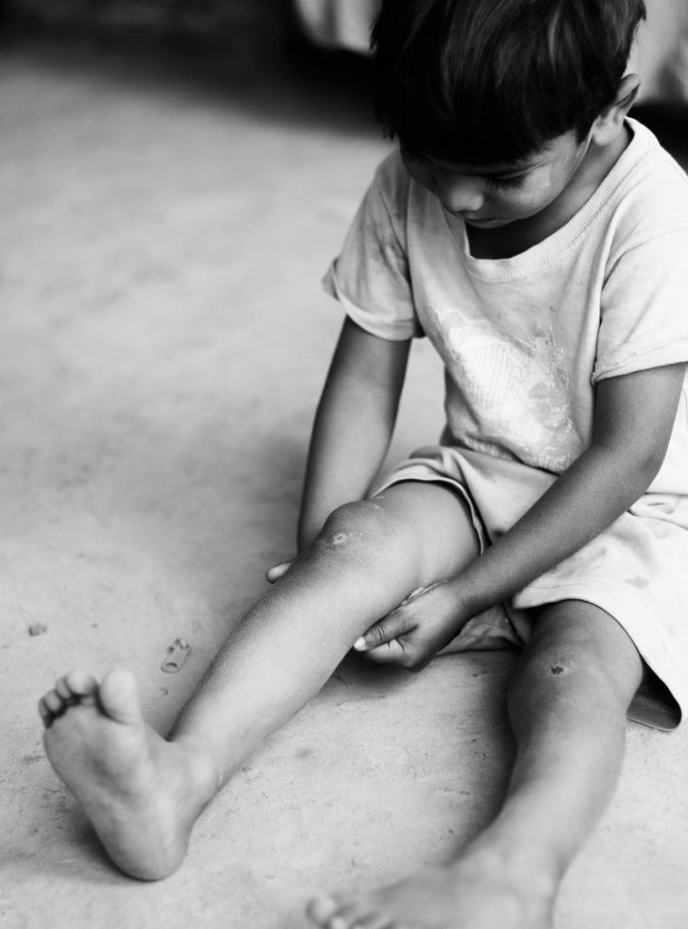 Episode #8 - Scars Tell a Story